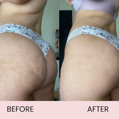 Anti-Cellulite Oil